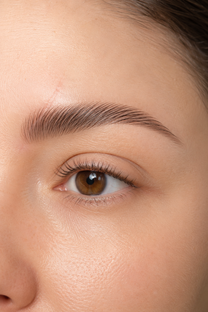 Precision Micro-Lift for Scarred Brows